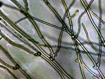 「シイタケ菌糸体」